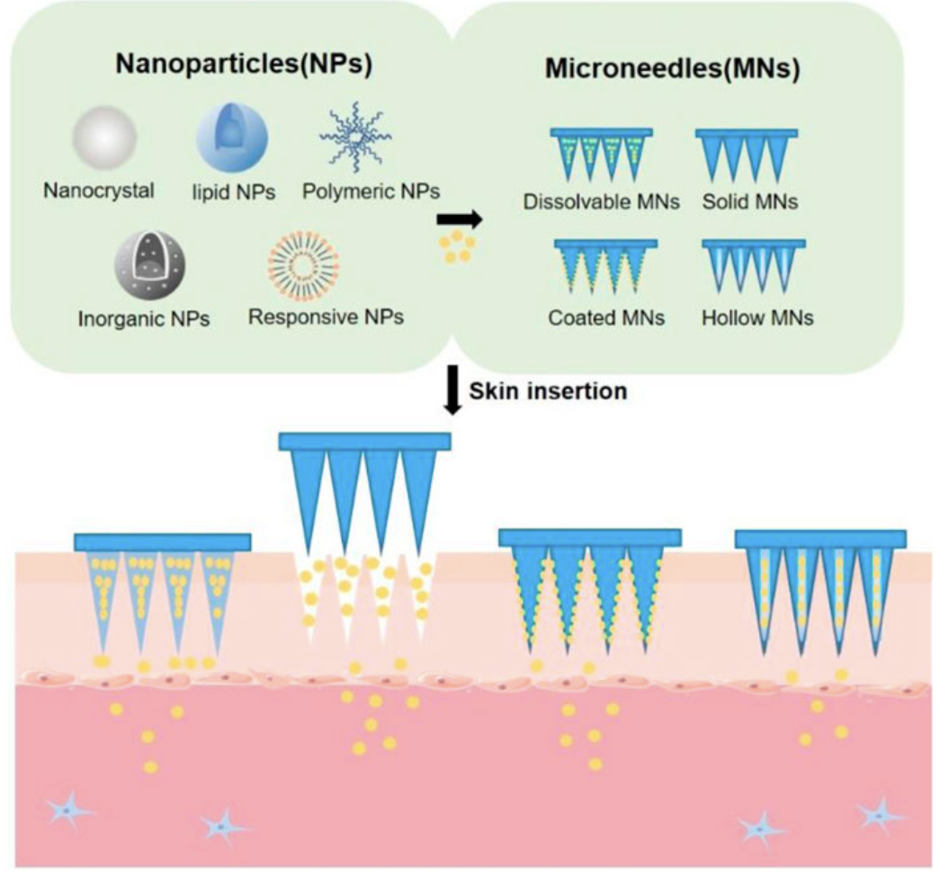 microneedle